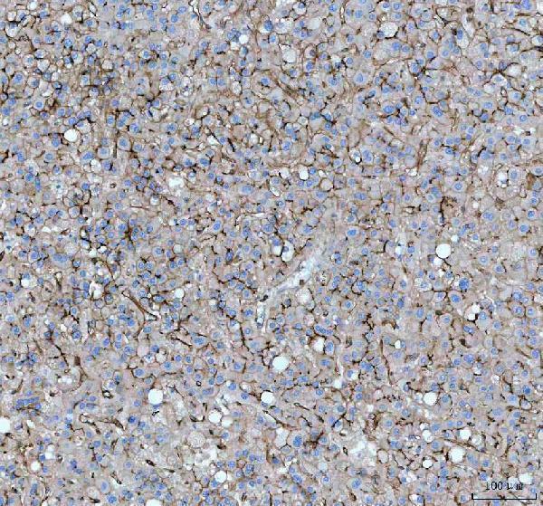 m00923 2 ceacam1 primary antibodies ihc testing 3