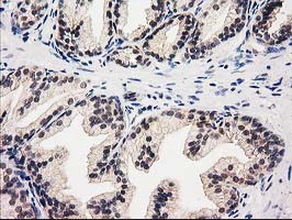 Immunohistochemical staining of paraffin-embedded Human prostate tissue within the normal limits using anti-GSS mouse monoclonal antibody