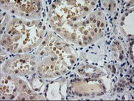 m00928 1 anti glutathione synthetase gss mouse monoclonal antibody clone id oti1b8 ihc testing 4