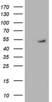 HEK293T cells were transfected with the pCMV6-ENTRY control (Left lane) or pCMV6-ENTRY GSS (Right lane) cDNA for 48 hrs and lysed