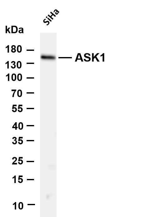 Various whole cell lysates were separated by 4-20% SDS-PAGE, and the membrane was blotted with anti-ASK1 antibody