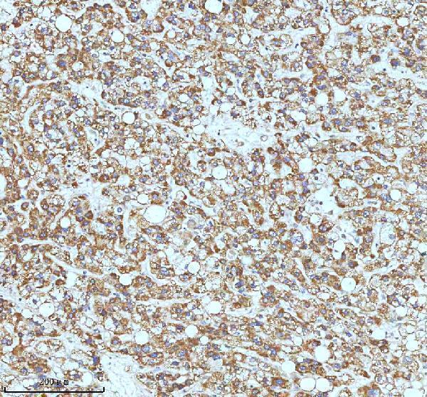 m00929 ask1 primary antibodies ihc testing 2_1