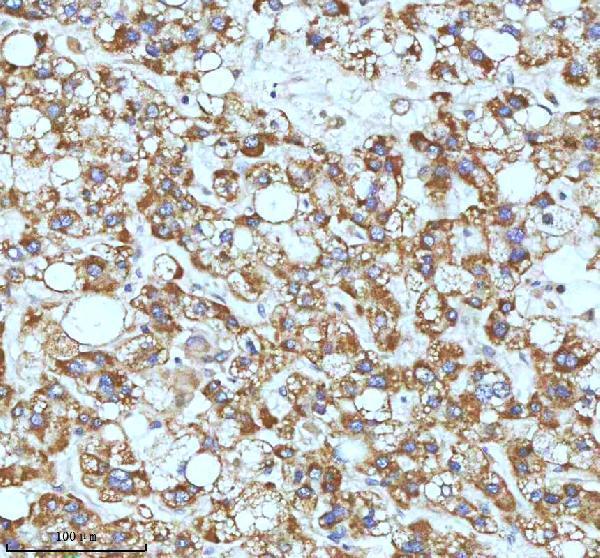 m00929 ask1 primary antibodies ihc testing 3_1