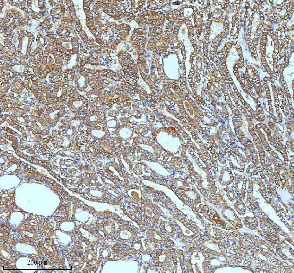 m00929 ask1 primary antibodies ihc testing 6_1