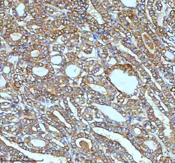 m00929 ask1 primary antibodies ihc testing 7_1