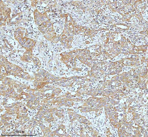 m00929 ask1 primary antibodies ihc testing 8_1