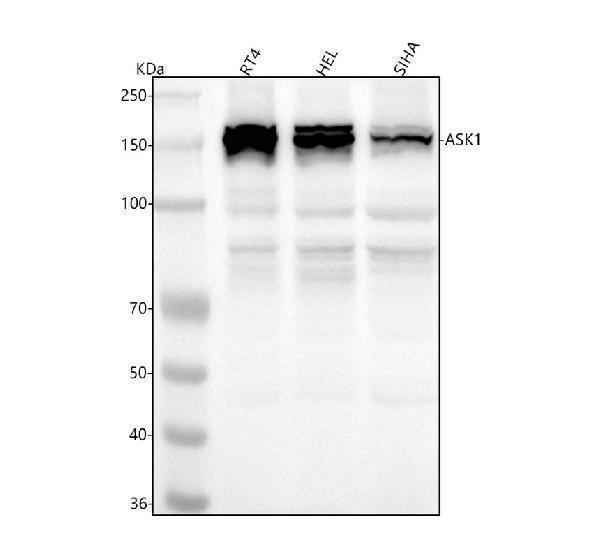  Western blot analysis of ASK1 using anti-ASK1 antibody (M00929)
