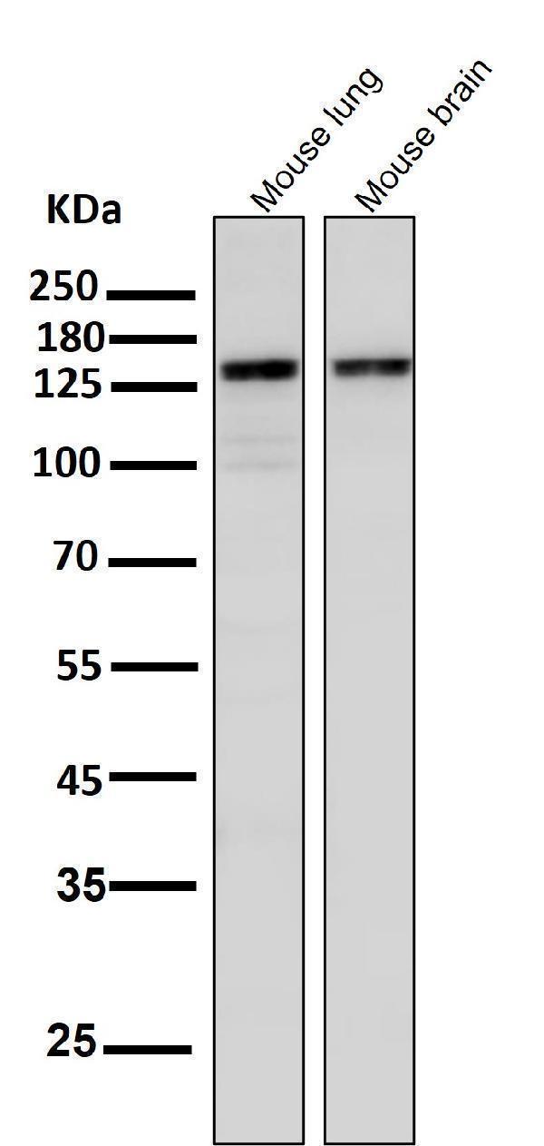 All lanes use the Antibody at 1:3K dilution for 1 hour at room temperature