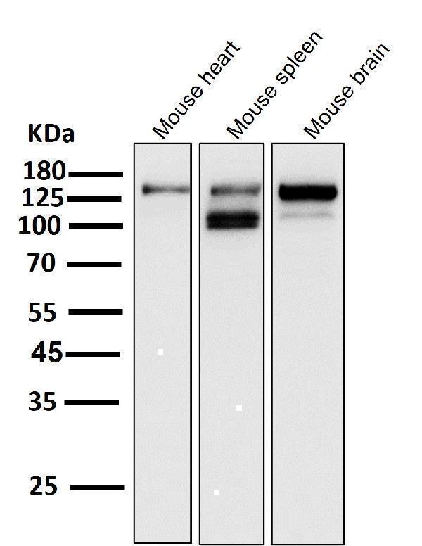All lanes use the Antibody at 1:1K dilution for 1 hour at room temperature