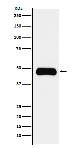Western blot analysis of Insulin Receptor R expression in Daudi cell lysate