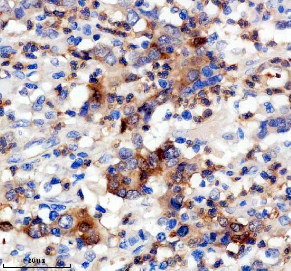 IHC analysis of BST2 using anti-BST2 antibody (M00934)