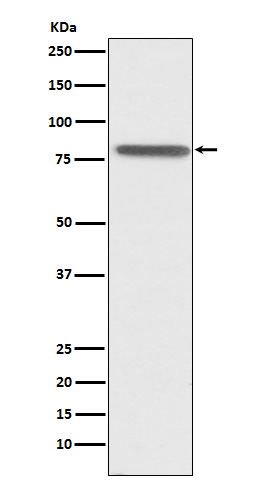 Western blot analysis of PSAP expression in HepG2 cell lysate