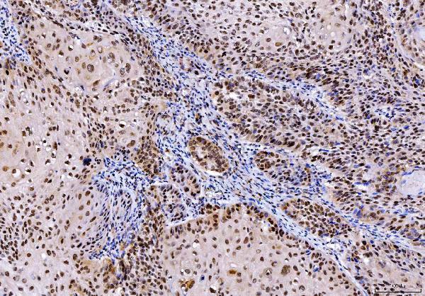  IHC analysis of SHP1/PTPN6 using anti-SHP1/PTPN6 antibody (M00938-2)