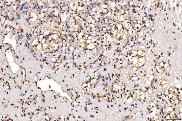  IHC analysis of SHP1/PTPN6 using anti-SHP1/PTPN6 antibody (M00938-2)