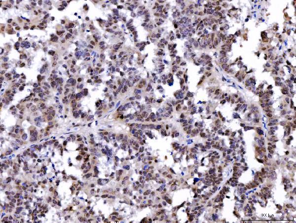 m00938 2 ptpn6 primary antibodies ihc testing 4