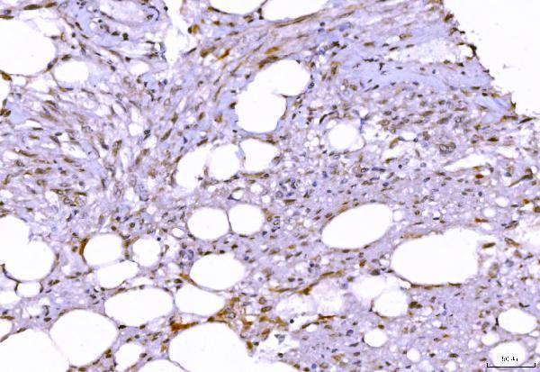 m00938 2 ptpn6 primary antibodies ihc testing 5