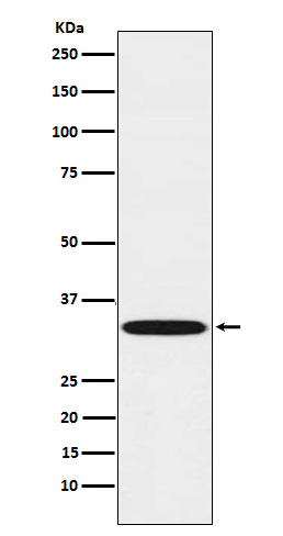Western blot analysis of TREX1 expression in Daudi cell lysate