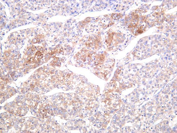 m00941 2 fasn primary antibodies ihc testing 1