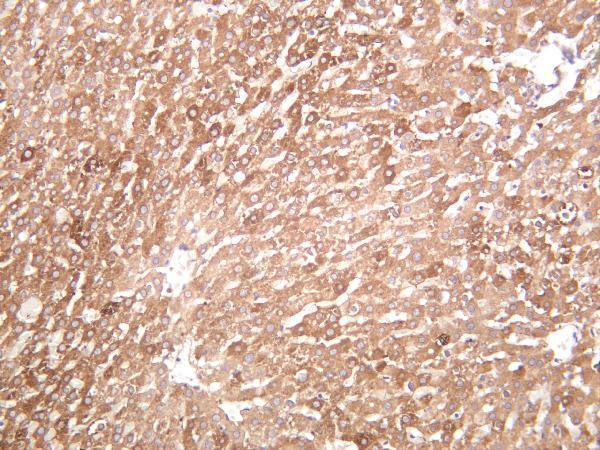m00941 2 fasn primary antibodies ihc testing 4