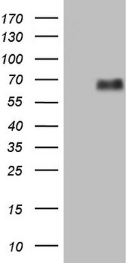 HEK293T cells were transfected with the pCMV6-ENTRY control (Left lane) or pCMV6-ENTRY LTBR (Right lane) cDNA for 48 hrs and lysed