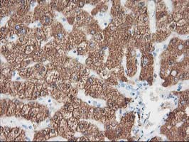m00947 1 anti cytochrome p450 2a6 cyp2a6 mouse monoclonal antibody clone id oti2a8 ihc testing 3