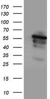 m00947 1 anti cytochrome p450 2a6 cyp2a6 mouse monoclonal antibody clone id oti2a8 wb testing 1