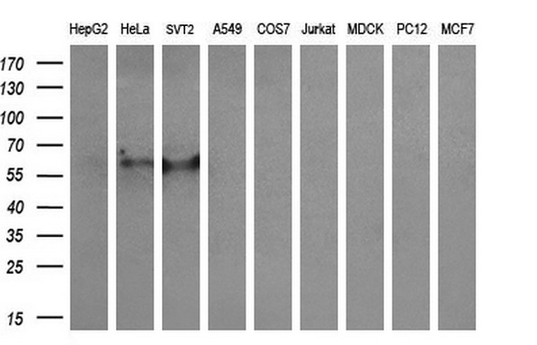 m00947 1 anti cytochrome p450 2a6 cyp2a6 mouse monoclonal antibody clone id oti2a8 wb testing 2