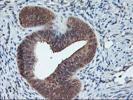 m00947 anti cytochrome p450 2a6 cyp2a6 mouse monoclonal antibody clone id oti1d2 ihc testing 4