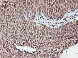 m00947 anti cytochrome p450 2a6 cyp2a6 mouse monoclonal antibody clone id oti1d2 ihc testing 8