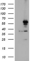 HEK293T cells were transfected with the pCMV6-ENTRY control (Left lane) or pCMV6-ENTRY CYP2A6 (Right lane) cDNA for 48 hrs and lysed