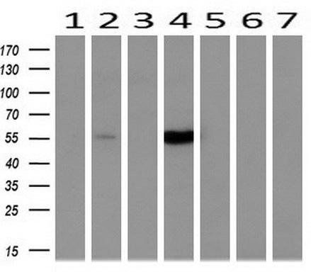 Western blot analysis of extracts (10ug) from 7 Human tissue by using anti-CYP2A6 monoclonal antibody ( 1: Uterus; 2: Breast; 3: Brain; 4: Liver; 5: Ovary; 6: Thyroid gland; 7: colon) at 1:200 dilution