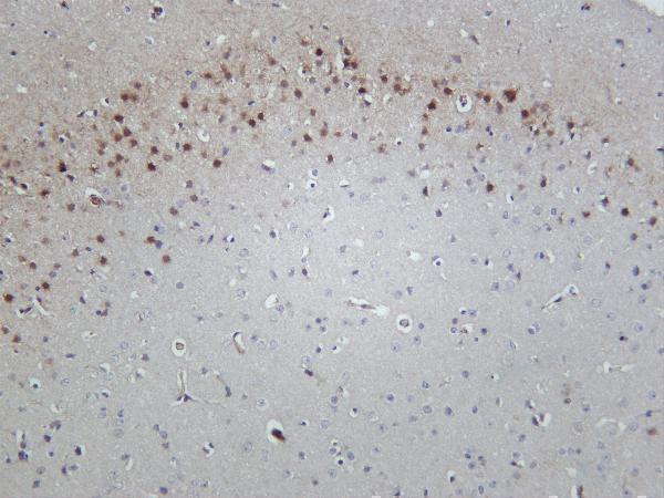 m00949 3 hsp70 primary antibodies ihc testing 1