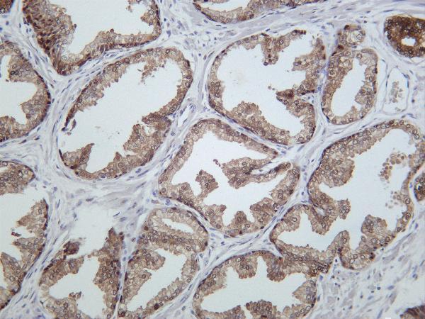 m00949 3 hsp70 primary antibodies ihc testing 2