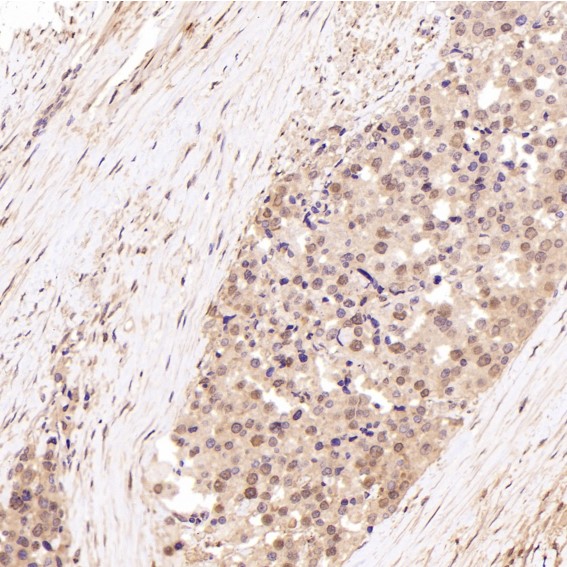 m00949 ihc9