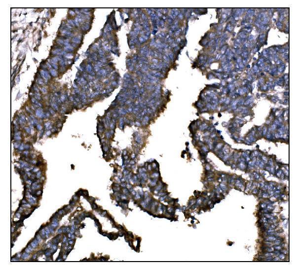  IHC analysis of IGF2R using anti-IGF2R antibody (M00951-1)
