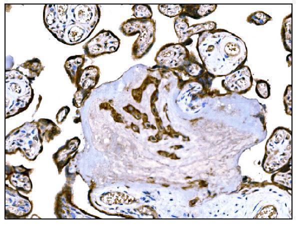  IHC analysis of IGF2R using anti-IGF2R antibody (M00951-1)