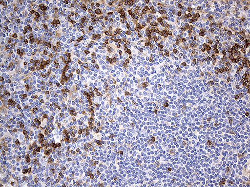Immunohistochemical staining of paraffin-embedded Human spleen tissue within the normal limits using anti-OPTN mouse monoclonal antibody
