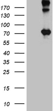 HEK293T cells were transfected with the pCMV6-ENTRY control (Left lane) or pCMV6-ENTRY OPTN (Right lane) cDNA for 48 hrs and lysed