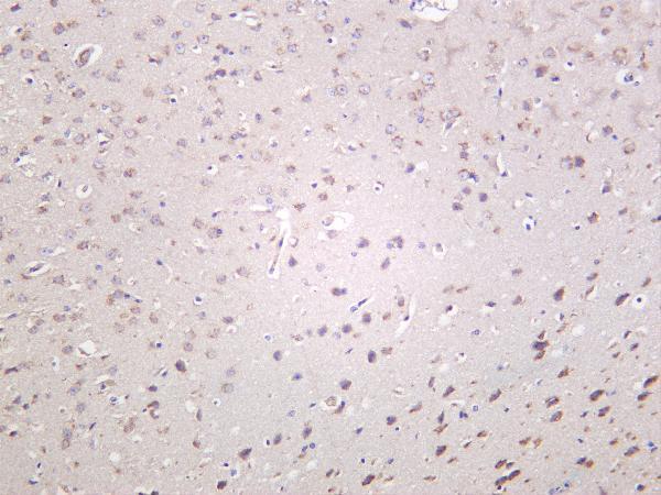 Mouse brain was stained with Anti-Optineurin rabbit antibody