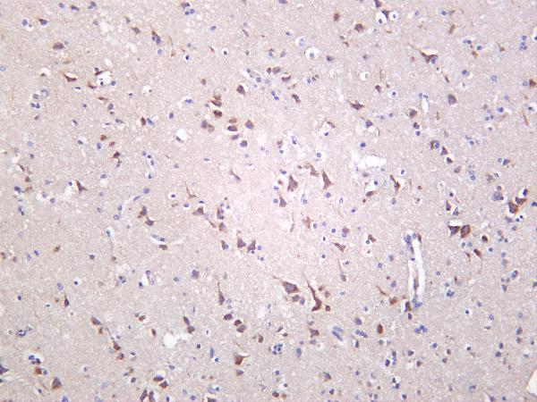Human brain was stained with Anti-Optineurin rabbit antibody