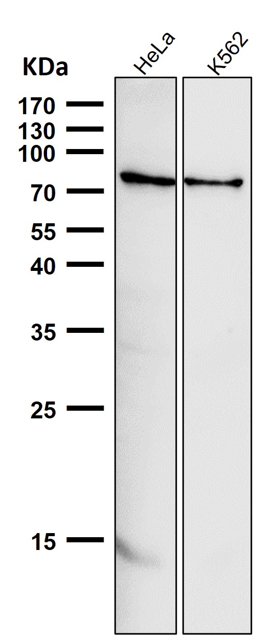 All lanes use the Antibody at 1:2K dilution for 1 hour at room temperature