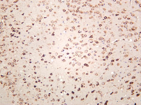 m00955 4 hspa5 primary antibodies ihc testing 4