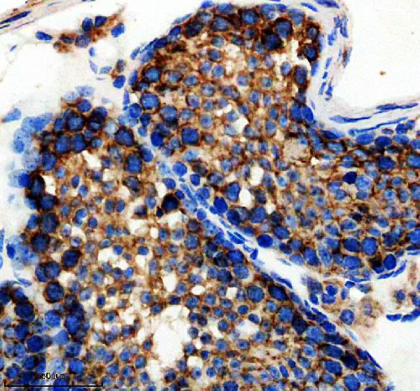 m00955 5 hspa5 primary antibodies ihc testing 1
