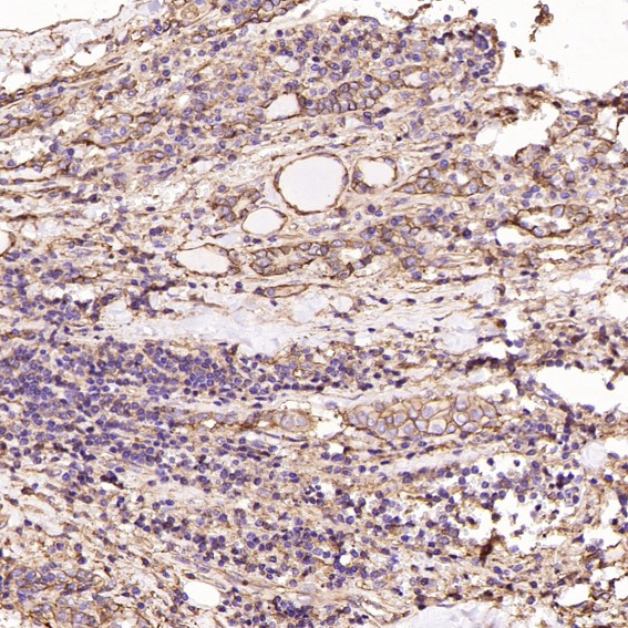 m00956 ihc10