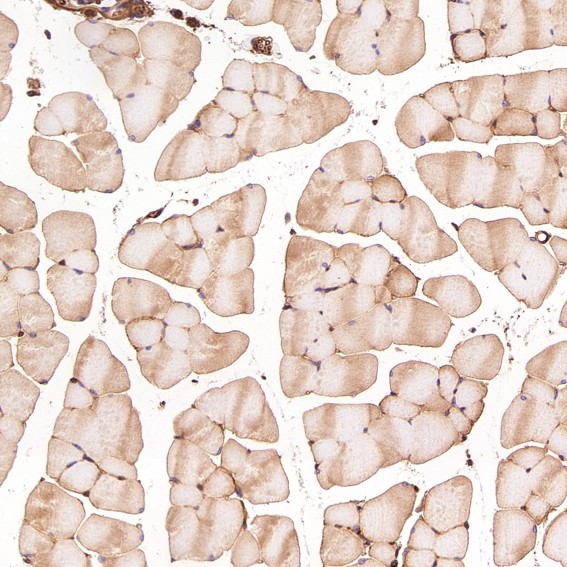 m00956 ihc11