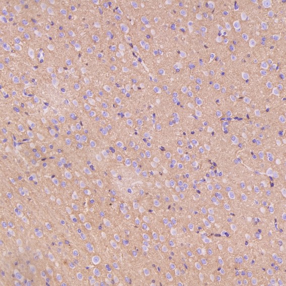 m00956 ihc7