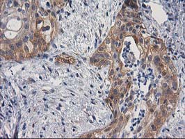m00960 1 anti bcar1 mouse monoclonal antibody clone id oti1a9 ihc testing 3