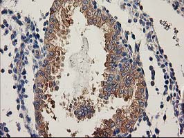 m00960 anti bcar1 mouse monoclonal antibody clone id oti1b1 ihc testing 3