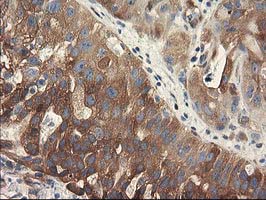 m00960 anti bcar1 mouse monoclonal antibody clone id oti1b1 ihc testing 4