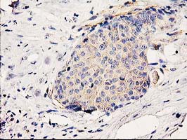 m00960 anti bcar1 mouse monoclonal antibody clone id oti1b1 ihc testing 5